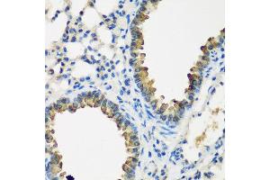 Immunohistochemistry of paraffin-embedded mouse lung using CYP2F1 antibody at dilution of 1:200 (40x lens).