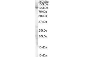 Western Blotting (WB) image for anti-Sp1 Transcription Factor (SP1) (AA 68-82) antibody (ABIN291116) (SP1 antibody  (AA 68-82))