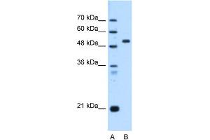 WB Suggested Anti-ST14 Antibody Titration:  0. (ST14 antibody  (C-Term))