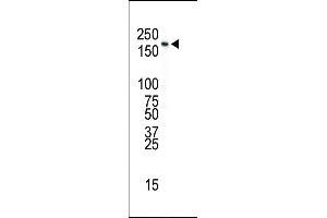 Western blot analysis of anti-INSR Pab in SK-BR-3 cell lysate (Insulin antibody  (N-Term))