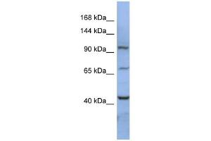 RBM12 antibody used at 1 ug/ml to detect target protein. (RBM12 antibody  (N-Term))