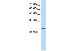 WB Suggested Anti-TNNI1 Antibody Titration:  0. (TNNI1 antibody  (N-Term))