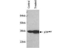 Mab anti-Human p34cdc2 antibody was used to detect human p34cdc2by western blot in untreated (control) and drug treated (10 µM genistein) lysates of MCF-7 cells. (Cdc2, p34 antibody)