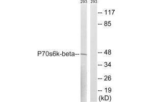 Western blot analysis of extracts from 293 cells, using p70 S6 Kinase β (Ab-423) antibody. (RPS6KB2 antibody  (Ser423))