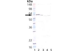 Western Blot Analysis of PDI: Lane 1: MWM, Lane 2: PDI (human), (recombinant) (His-tag) , Lane 3: HeLa, (cell lysate) , Lane 4: Rat Testis Tissue Lysate, Lane 5: Mouse Spleen Tissue Lysate. (P4HB antibody)