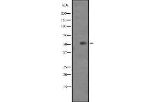 Western blot analysis of KRT82 expression in Mouse heart tissue lysates ,The lane on the left is treated with the antigen-specific peptide. (Keratin 82 antibody  (C-Term))
