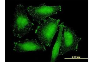 Immunofluorescence of purified MaxPab antibody to SORBS2 on HepG2 cell. (Sorbs2 antibody  (AA 1-1100))