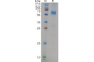 SDS-PAGE (SDS) image for SARS-CoV-2 Nucleocapsid (SARS-CoV-2 N) (B.1.617.2 - delta) protein (His tag) (ABIN7490603)