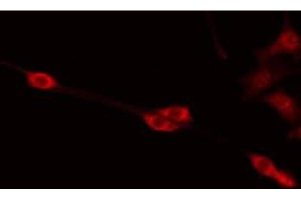 PABPC5 antibody  (Internal Region)