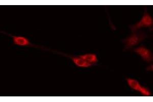 ABIN6275368 staining Hela by IF/ICC. (PABPC5 antibody  (Internal Region))