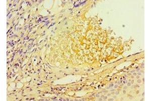 Immunohistochemistry of paraffin-embedded human blood plasma tissue using ABIN7171737 at dilution of 1:100 (RAP1 antibody  (AA 1-280))