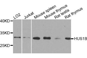 Western blot analysis of extracts of various cell lines, using HUS1B antibody. (HUS1B antibody)
