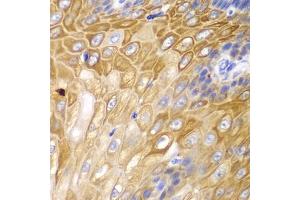 Immunohistochemistry of paraffin-embedded human esophagus using Cyclin D1 antibody (ABIN6127677, ABIN6138079, ABIN6138081 and ABIN6213800) at dilution of 1:100 (40x lens). (Cyclin D1 antibody  (AA 96-295))