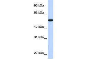 WB Suggested Anti-C9orf43 Antibody Titration: 0. (C9orf43 antibody  (Middle Region))