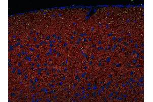 Indirect immunostaining of PFA fixed paraffin embedded mouse cortex section with anti-Homer 1/2/3 (dilution 1 : 500; red) and mouse anti-SERT (green). (Homer 1/2/3 (AA 1-176), (AA 1-177), (AA 1-196) antibody)