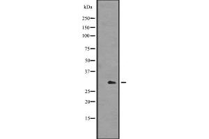 Western blot analysis of ING4 expression in A431 cell lysate ,The lane on the left is treated with the antigen-specific peptide. (ING4 antibody  (Internal Region))