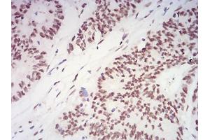Immunohistochemistry (IHC) image for anti-5'-3' Exoribonuclease 2 (XRN2) (AA 398-547) antibody (ABIN5542261)