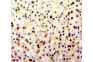 Used in DAB staining on fromalin fixed paraffin-embedded Liver tissue (GATA1 antibody  (AA 20-265))