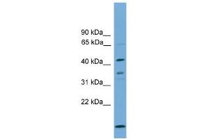 WB Suggested Anti-APOL5 Antibody Titration: 0. (Apolipoprotein L 5 antibody  (C-Term))