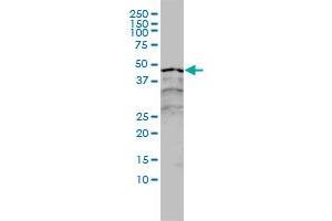 RARA monoclonal antibody (M01), clone 2C9-1F8 Western Blot analysis of RARA expression in A-431 . (Retinoic Acid Receptor alpha antibody  (AA 1-462))