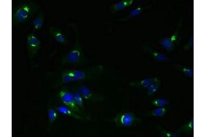 Immunofluorescent analysis of Hela cells using ABIN7173035 at dilution of 1:100 and Alexa Fluor 488-congugated AffiniPure Goat Anti-Rabbit IgG(H+L) (TMEM115 antibody  (AA 187-351))