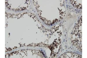 Immunoperoxidase of monoclonal antibody to PBK on formalin-fixed paraffin-embedded human testis. (PBK antibody  (AA 1-110))