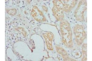 Immunohistochemistry of paraffin-embedded human kidney tissue using ABIN7155677 at dilution of 1:100 (DLX2 antibody  (AA 1-140))