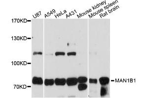 Western blot analysis of extracts of various cell lines, using MAN1B1 antibody (ABIN6291169) at 1:3000 dilution.