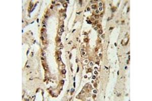 FOXP1 antibody IHC analysis in formalin fixed and paraffin embedded lung tissue.