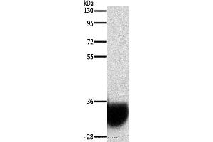Western blot analysis of Human fetal brain tissue, using GPM6A Polyclonal Antibody at dilution of 1:1050 (GPM6A antibody)