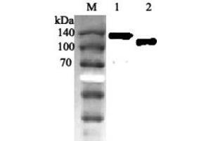 Western blot analysis using anti-ACE2 (human), pAb  at 1:2'000 dilution. (ACE2 antibody)