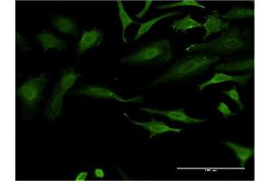 Immunofluorescence of monoclonal antibody to FOXO1 on HeLa cell. (FOXO1 antibody  (AA 452-555))