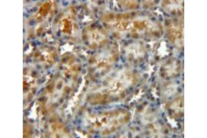 Used in DAB staining on fromalin fixed paraffin-embedded kidney tissue (CLIC4 antibody  (AA 104-253))