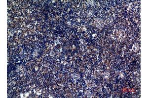 Immunohistochemistry (IHC) analysis of paraffin-embedded Human Tonsils, antibody was diluted at 1:100. (ICOS antibody)