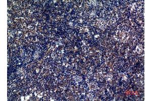 Immunohistochemistry (IHC) analysis of paraffin-embedded Human Tonsils, antibody was diluted at 1:100. (ICOS antibody)