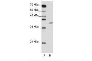 Image no. 1 for anti-Zinc Finger Protein 42 (ZFP42) (N-Term) antibody (ABIN6736154) (ZFP42 antibody  (N-Term))