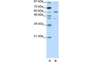 Western Blotting (WB) image for anti-Zinc Finger Protein 496 (ZNF496) antibody (ABIN2461953) (ZNF496 antibody)