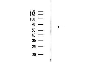anti-Solute Carrier Family 2 (Facilitated Glucose Transporter), Member 12 (SLC2A12) (C-Term) antibody