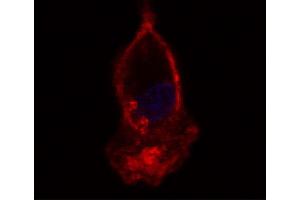 Hooded seal bronchoalveolar lavage cells were stained with Mouse Anti-Human CD14-UNLB:. (CD14 antibody)