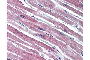 Anti-S100A1 / S100 antibody IHC of human heart.