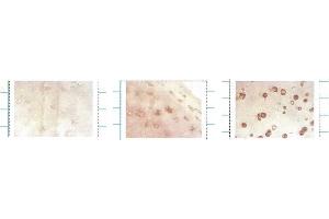 EC SOD (4GG11G6), Human cartilage, ICC Left control, middle young, right cartilage with osterarthritis (SOD3 antibody)