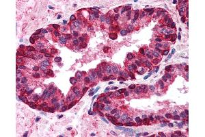 Anti-IRF3 antibody IHC of human prostate.