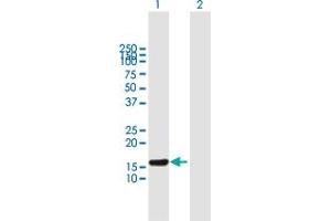 Western Blot analysis of ESCO1 expression in transfected 293T cell line by ESCO1 MaxPab polyclonal antibody. (ESCO1 antibody  (AA 1-172))