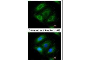 ICC/IF Image Immunofluorescence analysis of paraformaldehyde-fixed A549, using ERAB , antibody at 1:200 dilution. (HSD17B10 antibody  (C-Term))