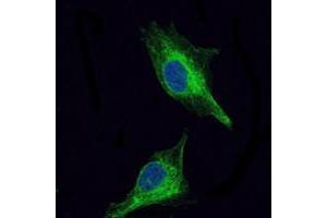 Immunofluorescence analysis of U251 cells using OLIG2 mouse mAb (green). (OLIG2 antibody)