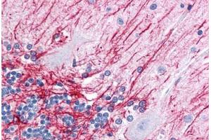 Human Brain, Cerebellum: Formalin-Fixed, Paraffin-Embedded (FFPE) (GFAP antibody)