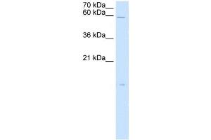 RARRES3 antibody used at 5 ug/ml to detect target protein. (RARRES3 antibody)