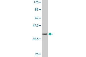 Western Blot detection against Immunogen (36. (CD130/gp130 antibody  (AA 23-122))
