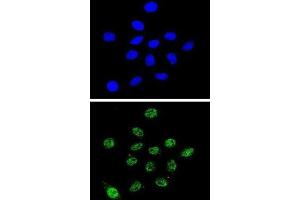 Immunofluorescence (IF) image for anti-Dyskeratosis Congenita 1, Dyskerin (DKC1) antibody (ABIN3002360)