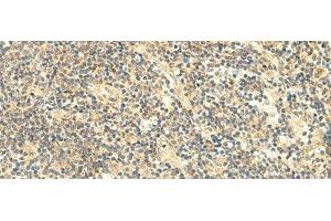Immunohistochemistry of paraffin-embedded Human tonsil tissue using HMBOX1 Polyclonal Antibody at dilution of 1:50(x200) (HMBOX1 antibody)